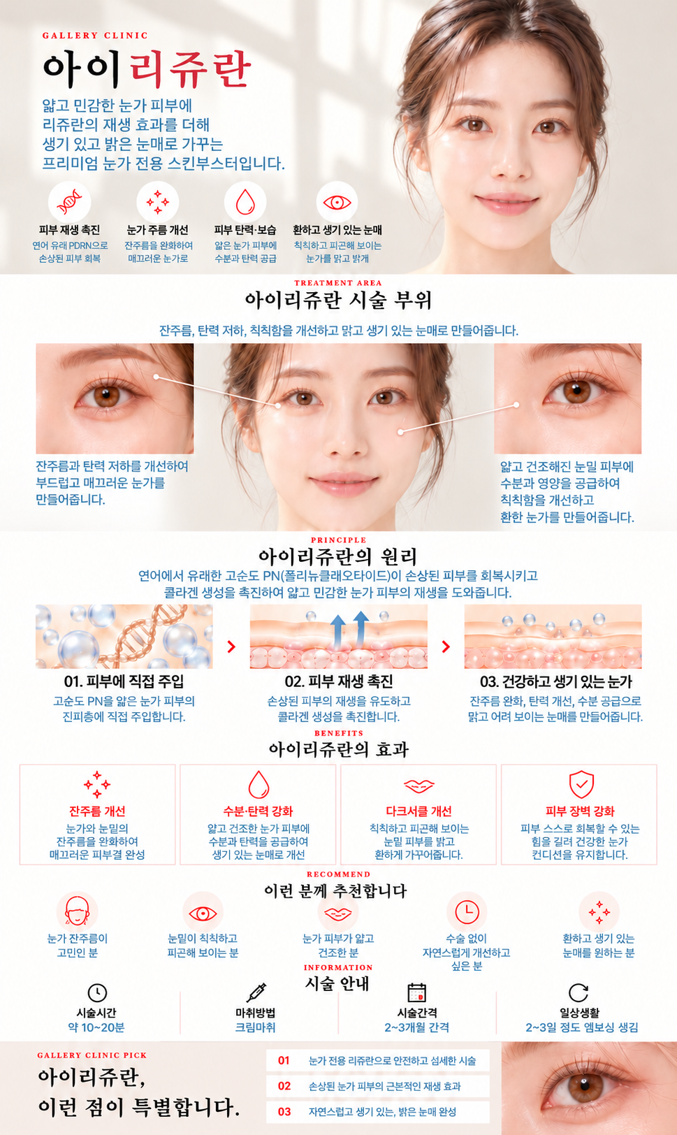 갤러리의원 아이리쥬란 상세 안내