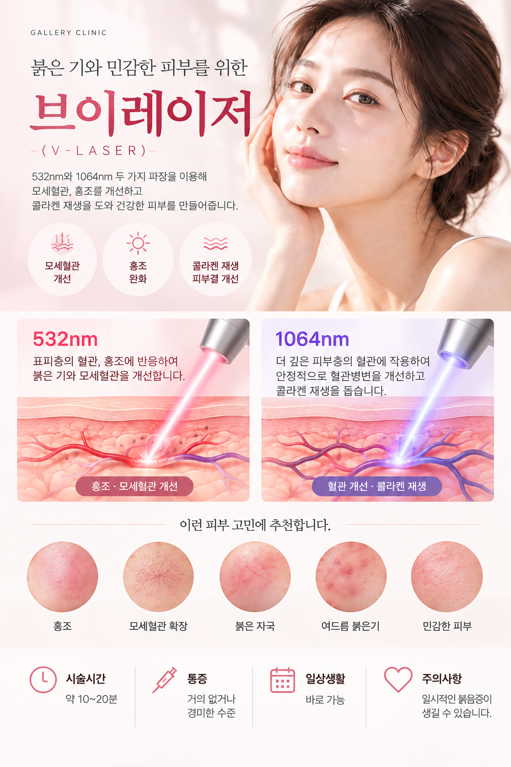 갤러리의원 브이레이저 상세 안내